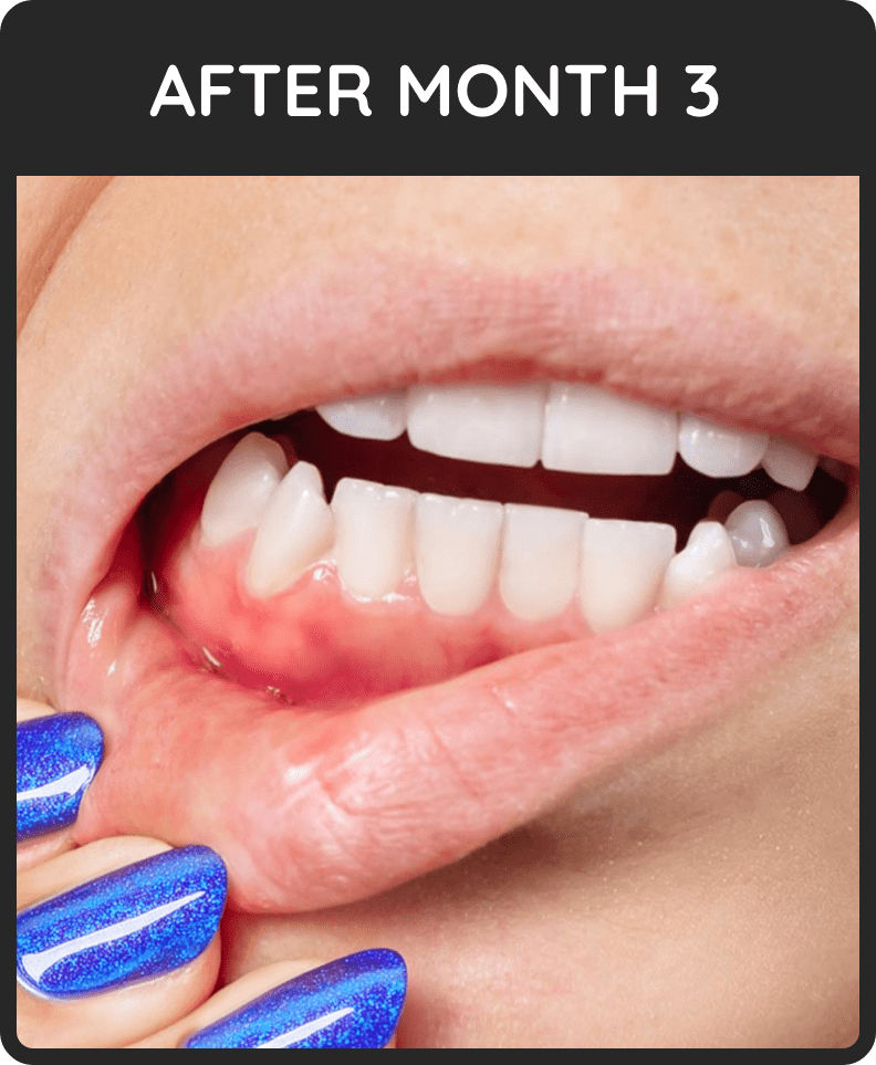 7 Honest ProDentim Review And Reviews Benefits & Side Effects.