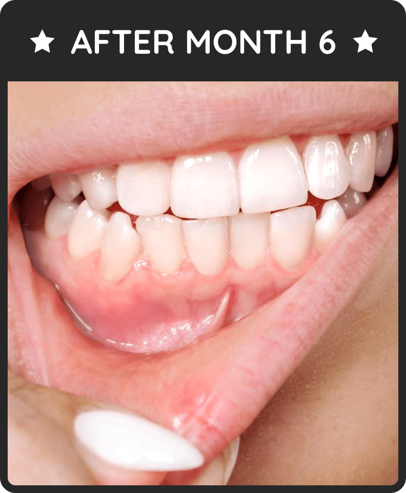 7 Honest ProDentim Review And Reviews Benefits & Side Effects.